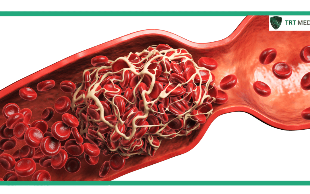 Does TRT Cause Blood Clots? Risk Factors