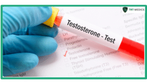Does Masturbation Raise or Lower Testosterone