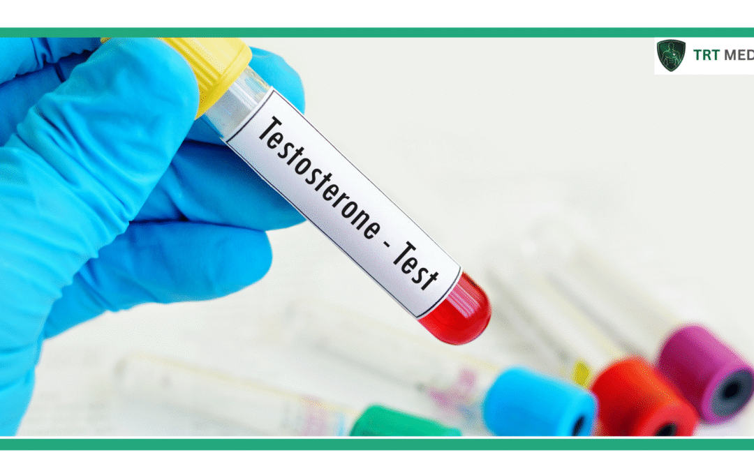 How to Boost Testosterone Levels Naturally